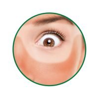 Close-up of face with visible tan lines – Tan Removal & Radiance Boost skincare concern